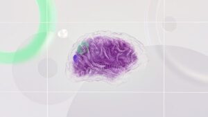 l'hypnose neuro-créative stimule les réseaux cérébraux favorisant le changement.